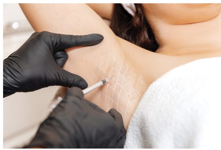 best hyperhidrosis near me in Vaughan