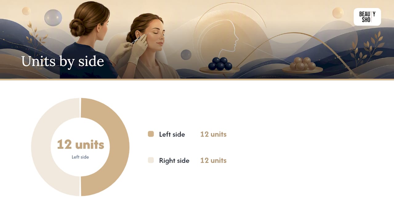 What to expect during a crow's feet Botox appointment — overview diagram