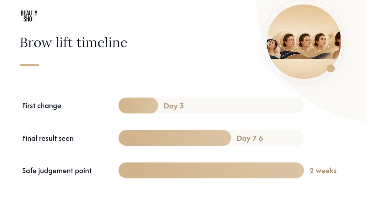 How long does a Dysport brow lift take to show, and how long does it last? — overview diagram