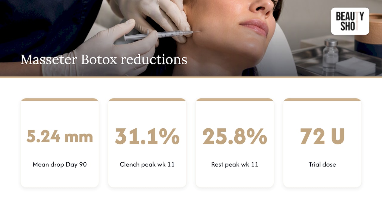 How masseter Botox reduces jaw width=