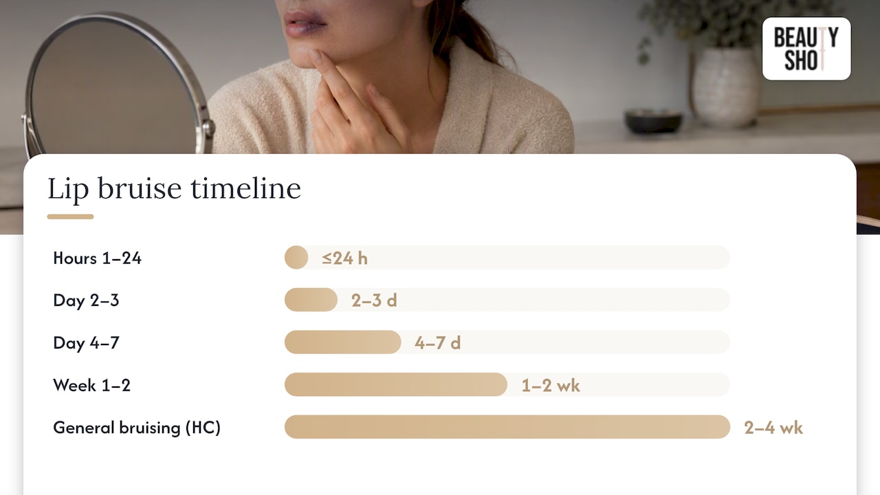 How long lip filler bruising lasts, day by day — overview diagram